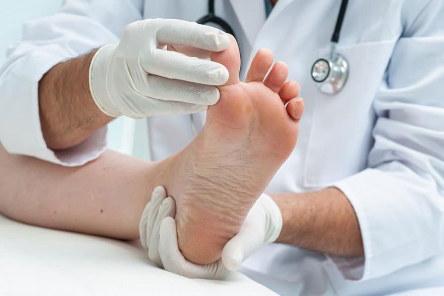 athletes-foot-treatment-dearborn-mi Athlete's Foot Treatment in Dearborn MI