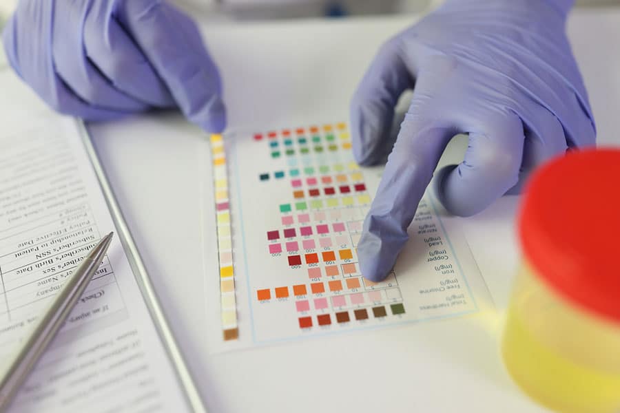 A person wearing purple gloves compares a urinalysis test strip to a color chart on a table, with a yellow urine sample container and a clipboard with papers nearby.